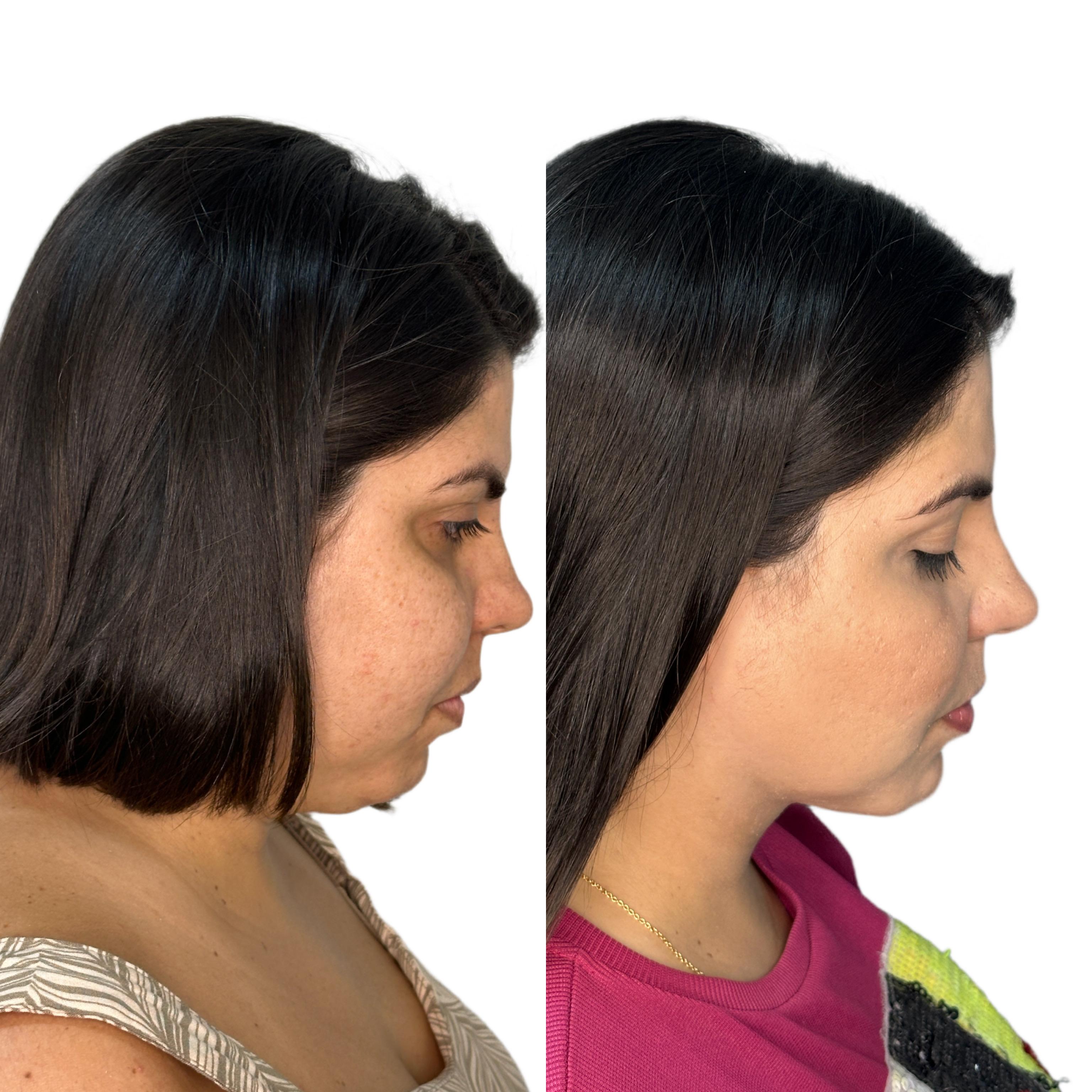 Descrição do caso 2