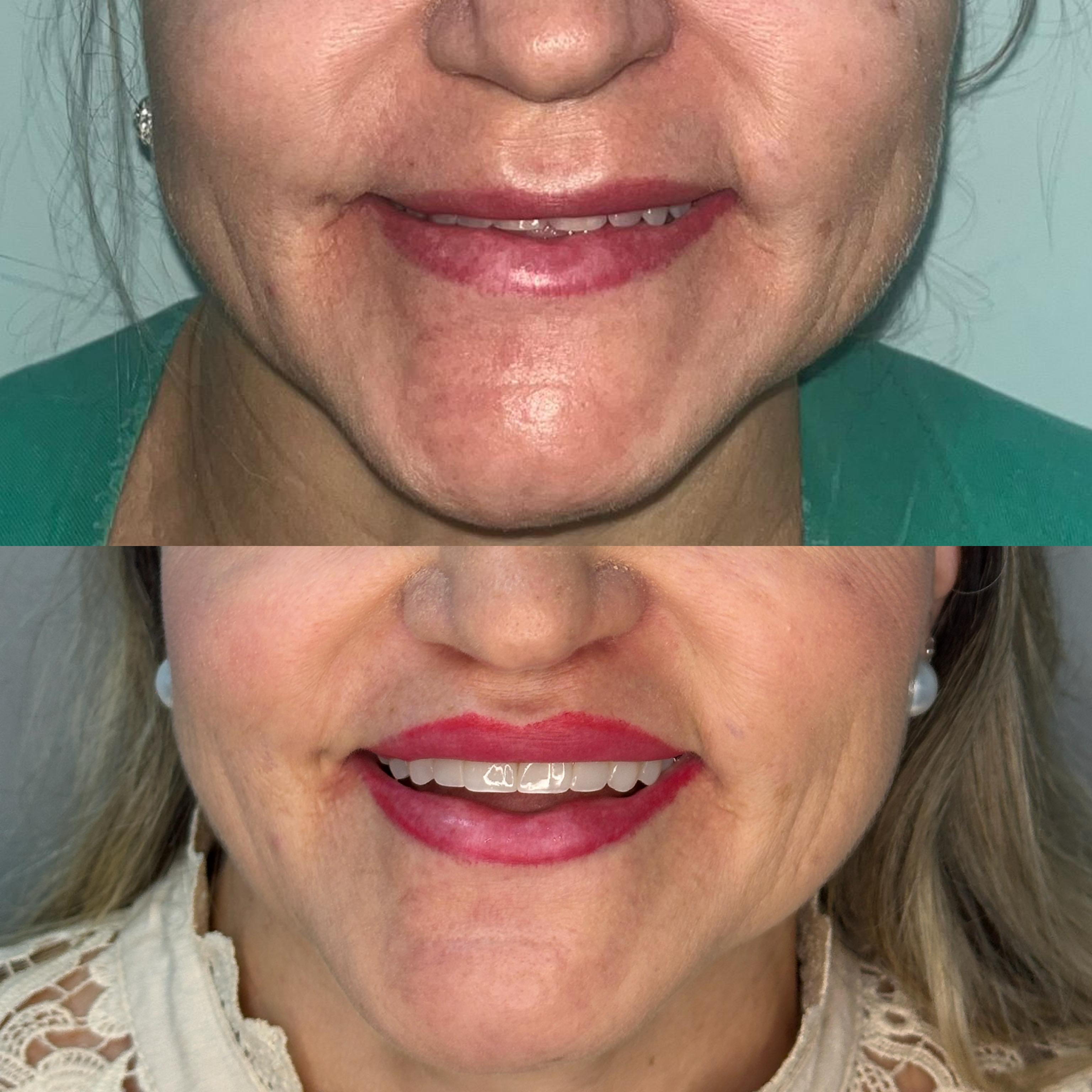 Descrição do caso 4